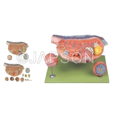 Ovary Model Ovary Model